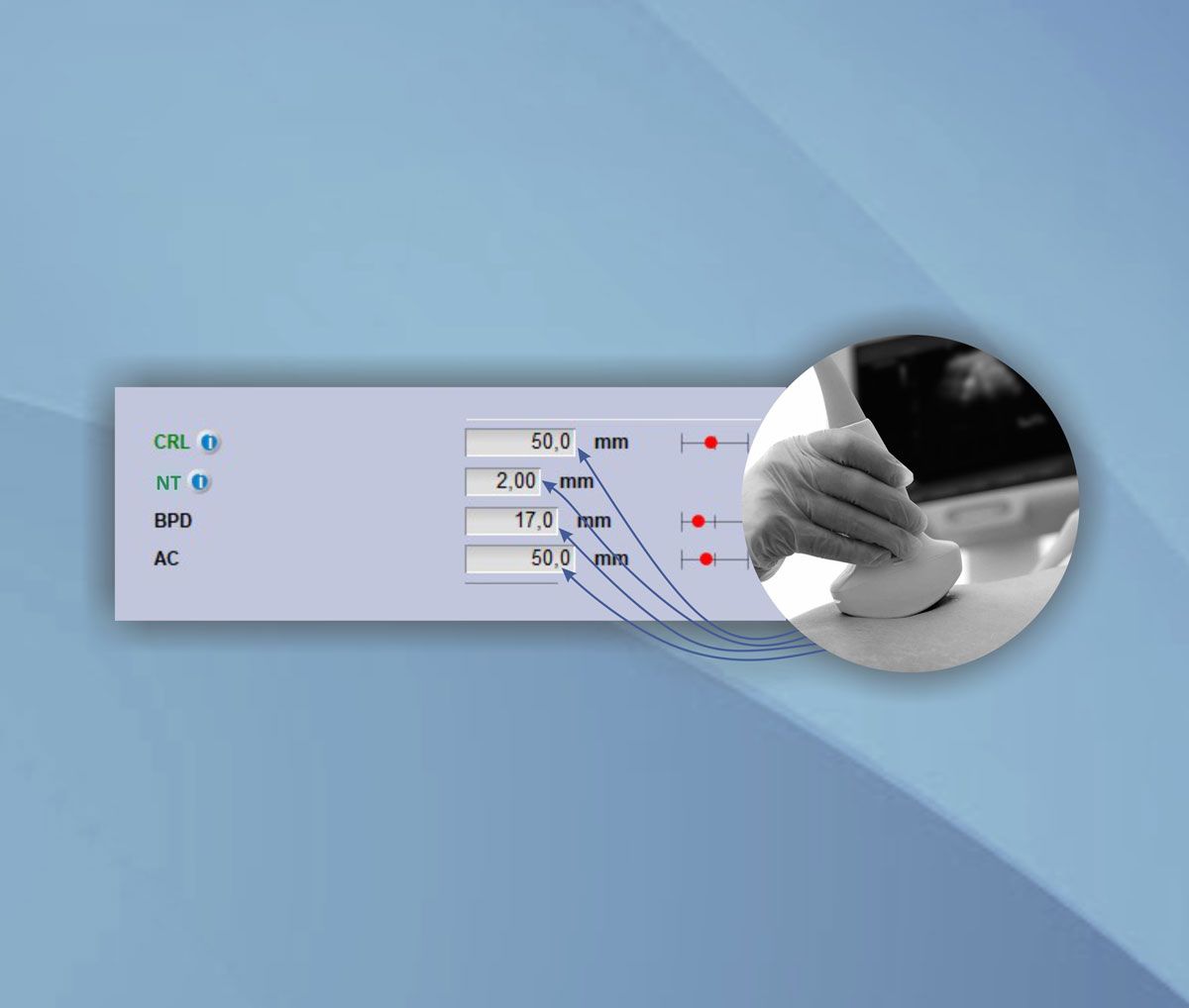 Measurement Data Transfer